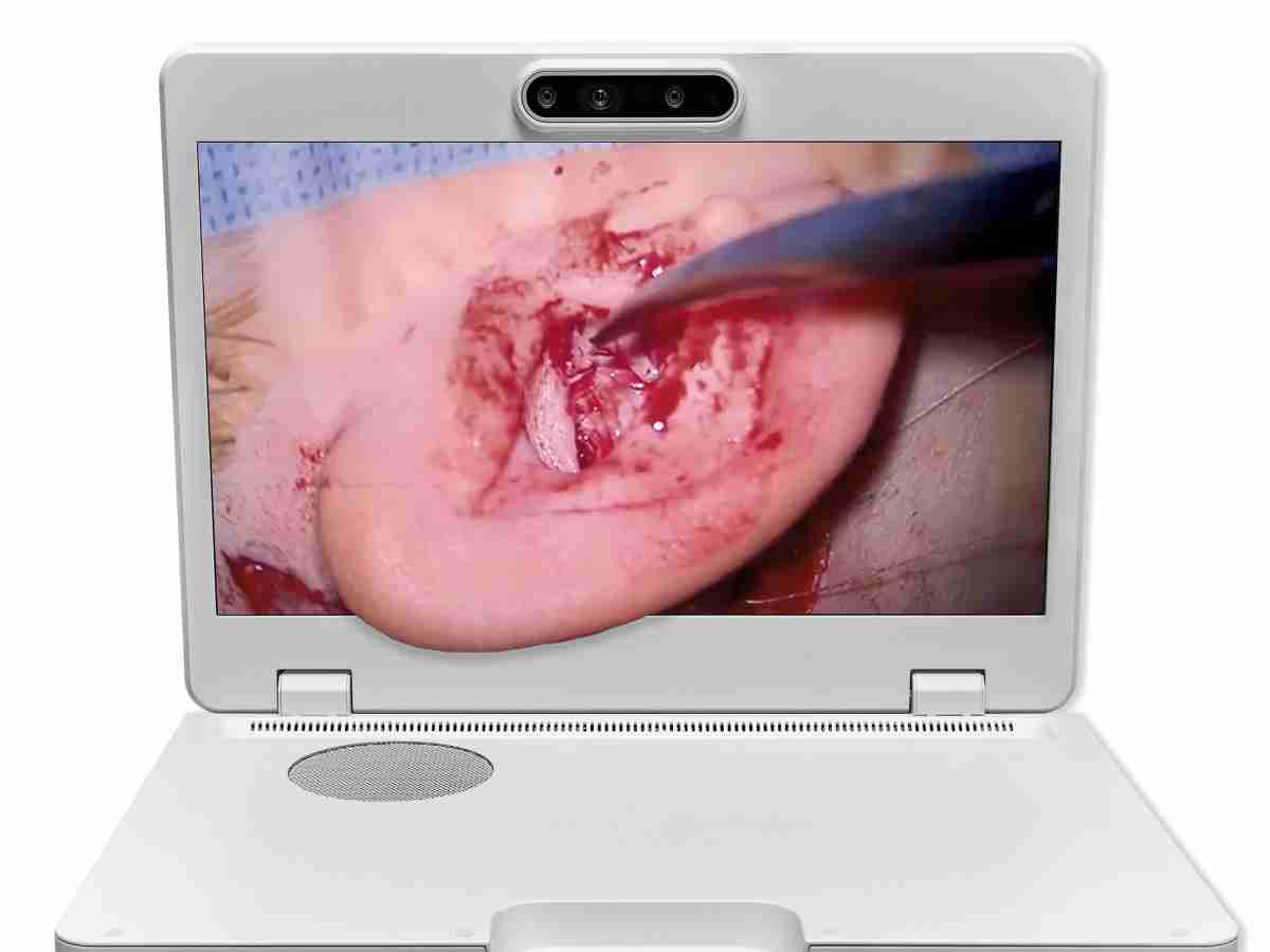 达擎之＂Heads-up 3D显微手术显示系统＂，，，整合4K裸眼3D显示及眼球追踪系统，，，具备快速追踪人眼移动位置功能，，，减轻医师长时间维持固定姿势的负担，，让医师能有更宽广清晰的3D立体视野及更舒适的姿势来执行手术。。。